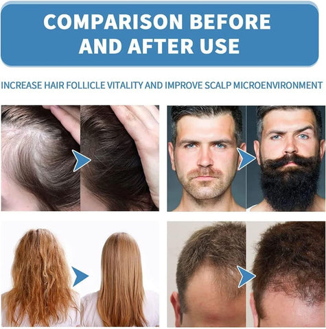 Hair Treatment Serum